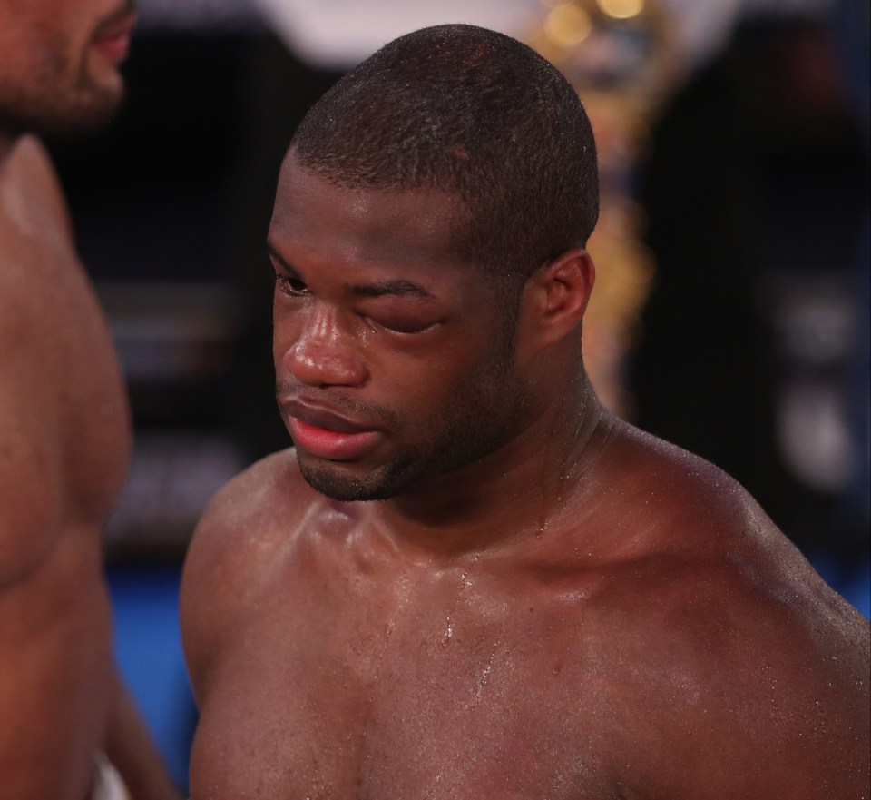 Dubois knew the game was up as he suffered his first ever defeat