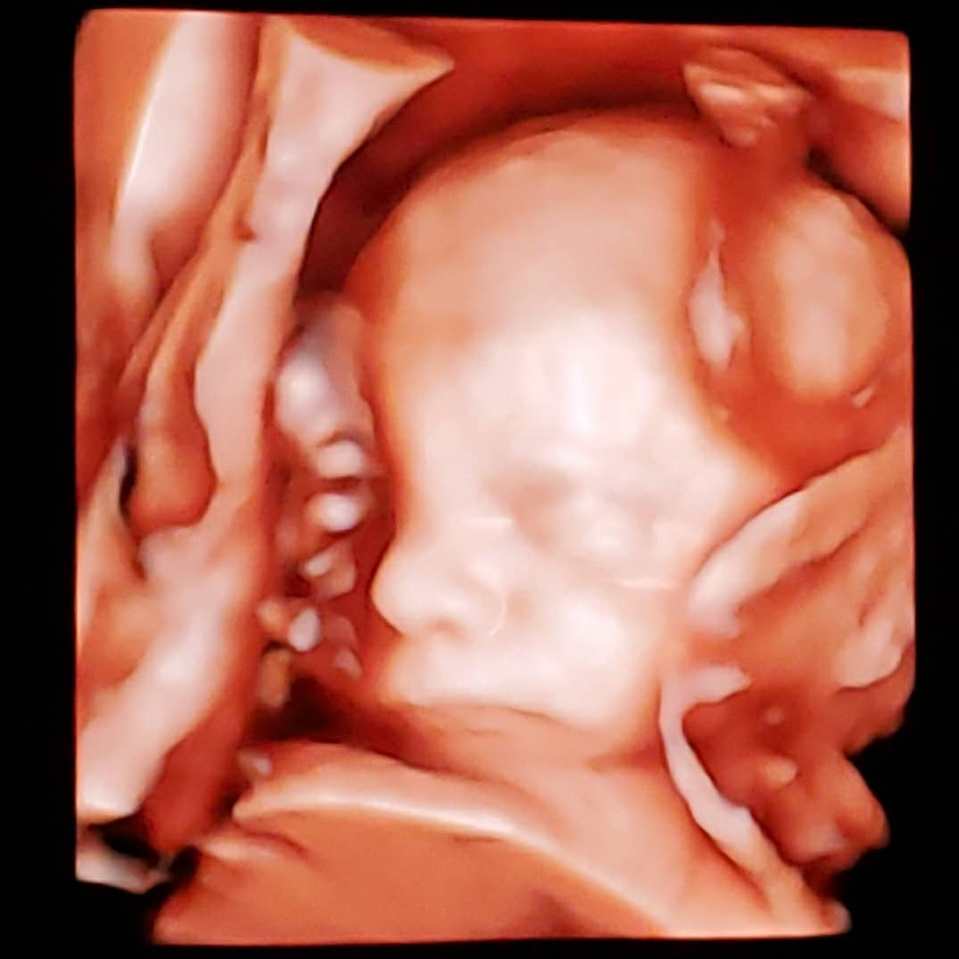 An ultrasound of the couple's son Oliver