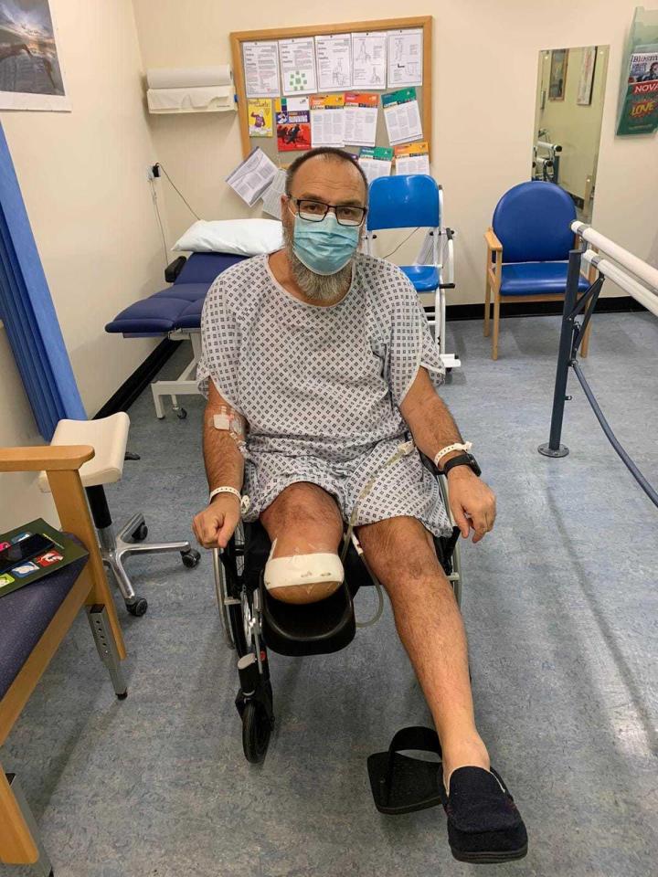 Lee Mabbatt was forced to have his leg amputated after coronavirus sparked a life-threatening blood clot