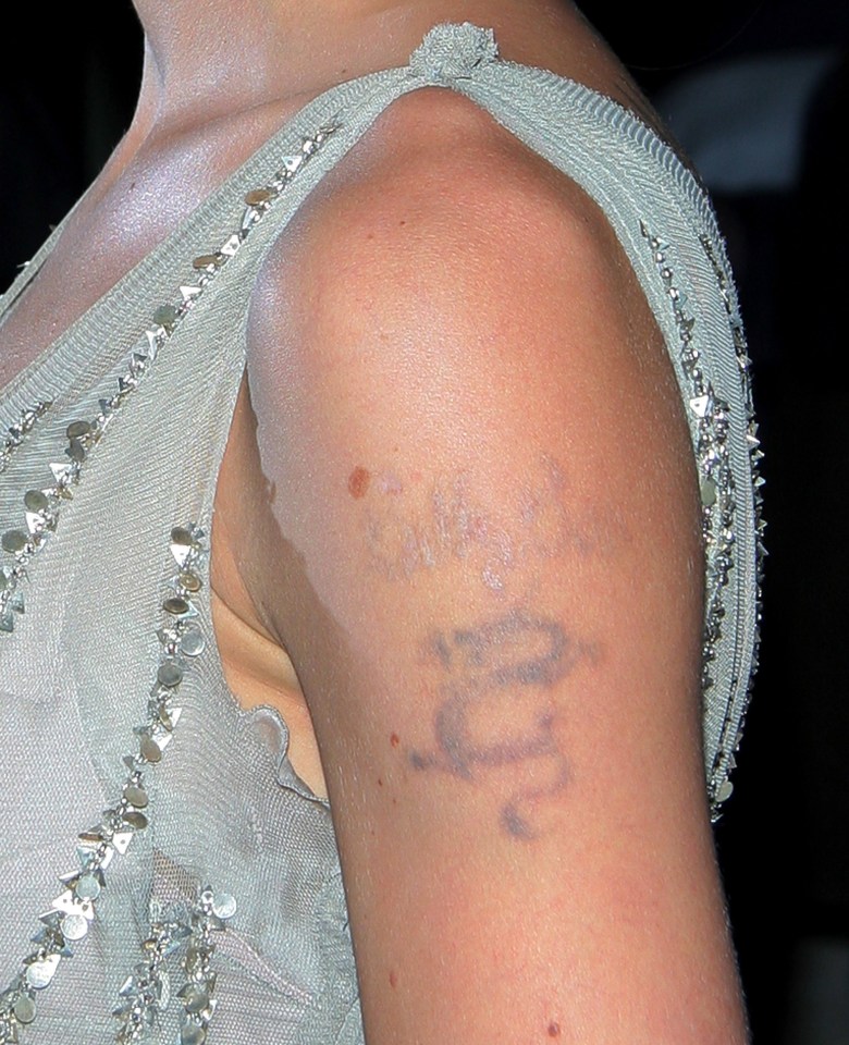 Angelina had her tattoo tribute to Billy Bob Thornton removed 