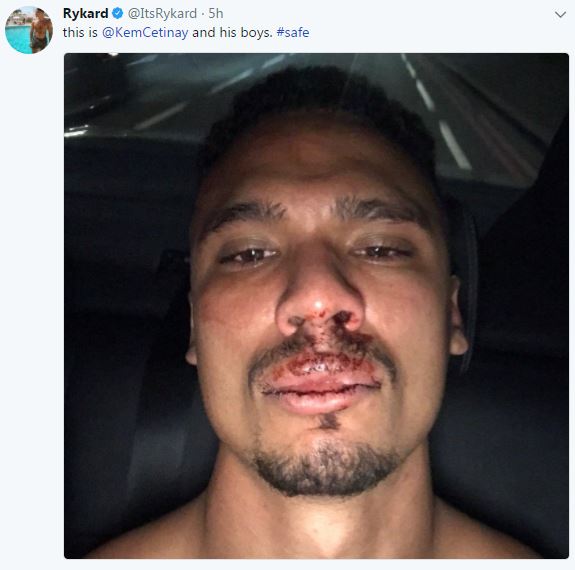 Rykard called out Kem and his friends alongside a bloody photo after the assault