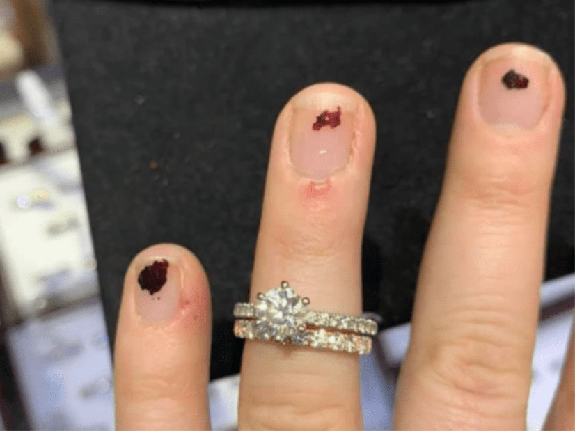 The woman asked for advice about her wedding ring - but was cruelly trolled for her chipped nail polish