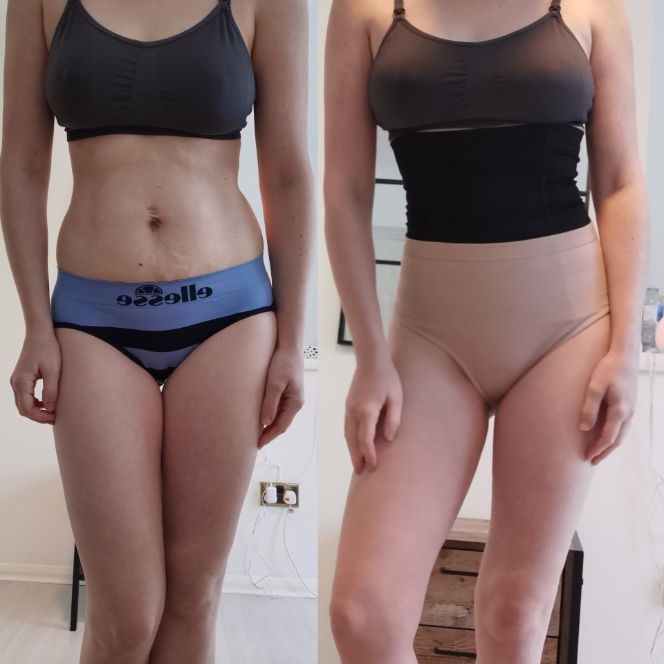 The shapewear will help heal my diastasis recti