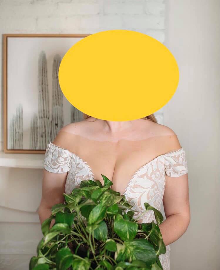 This photo of a bride on her wedding day has set tongues wagging after people accused her of a beauty blunder… but that’s NOT what’s going on