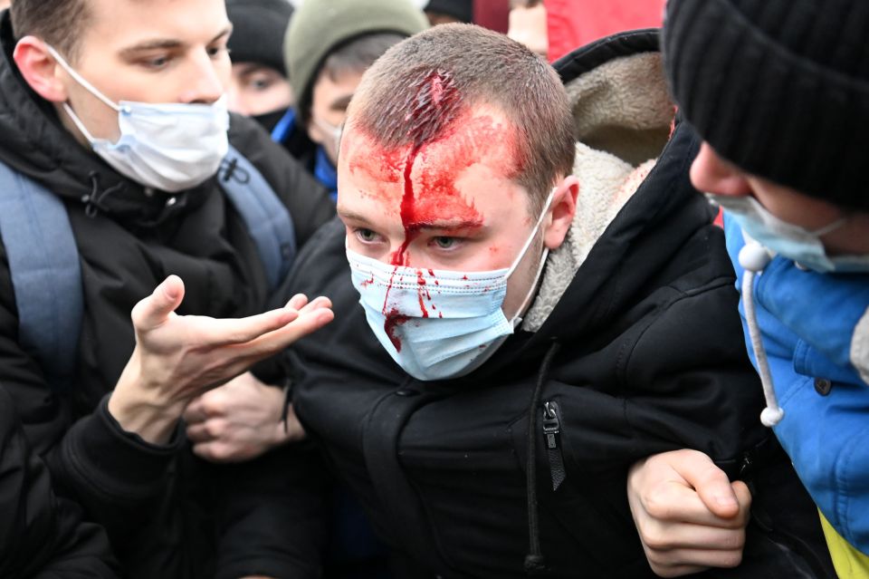 The protests in Russia have turned bloody