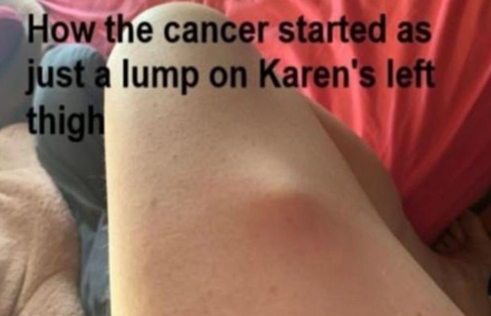 The lump on Karen's leg was painless 