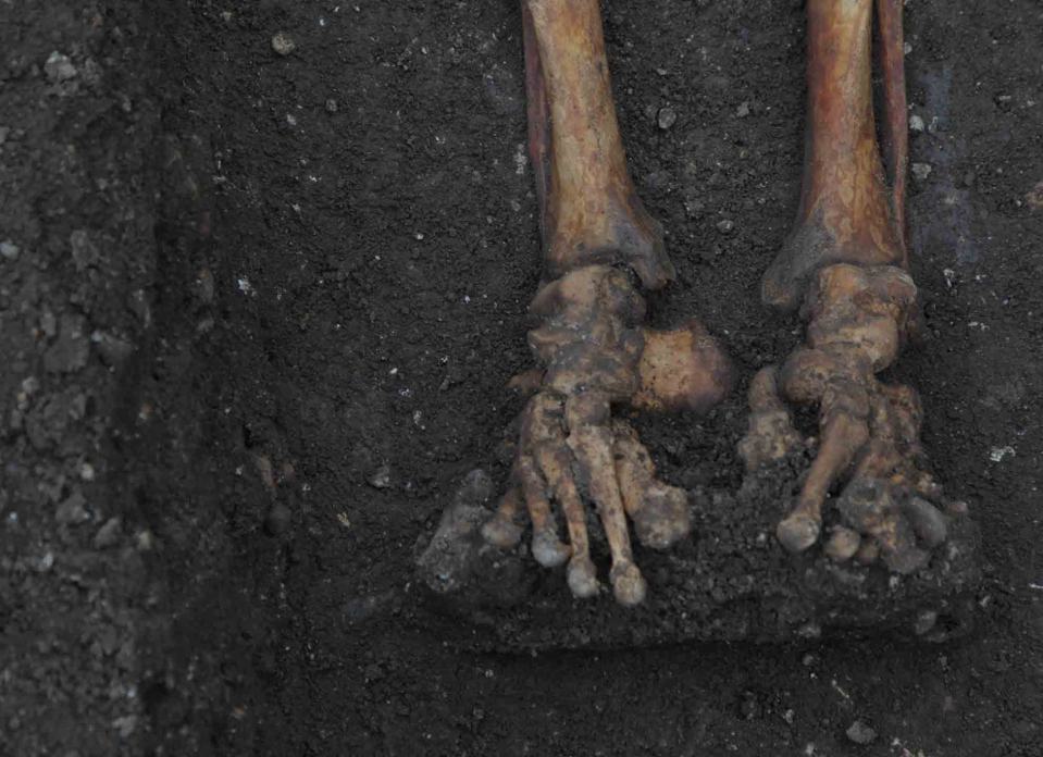 As many as 44 per cent of working people buried there had bone fractures, compared with 32 per cent of skeletons at an Augustinian friary that buried wealthy donors alongside clergy, according to a study about the findings