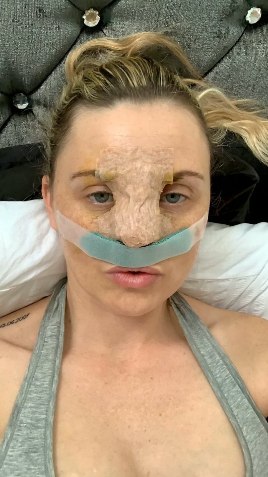 Carla previously faked depression to get a nose-job on the NHS