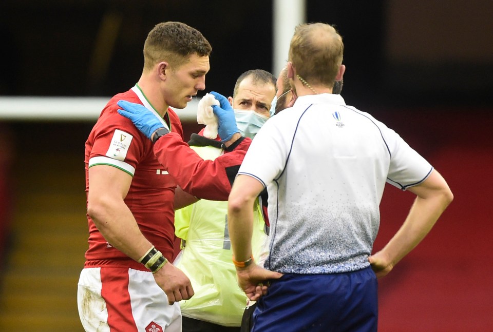 George North's impressive performance against Ireland will not be backed up after he suffered an eye injury in Cardiff