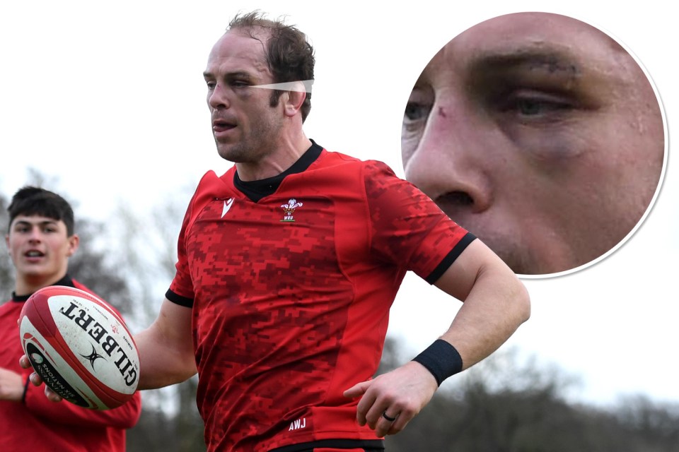 Alun Wyn Jones has caught a shiner in training ahead of the Ireland clash