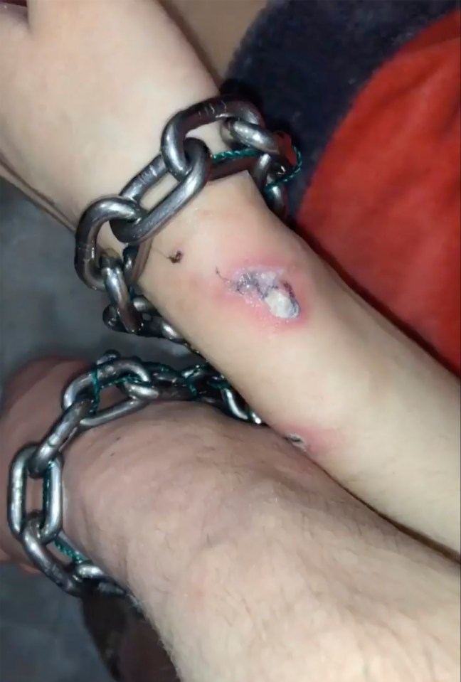 Viktoria has suffered from wounds on her wrist from the chain that binds her to Alexander