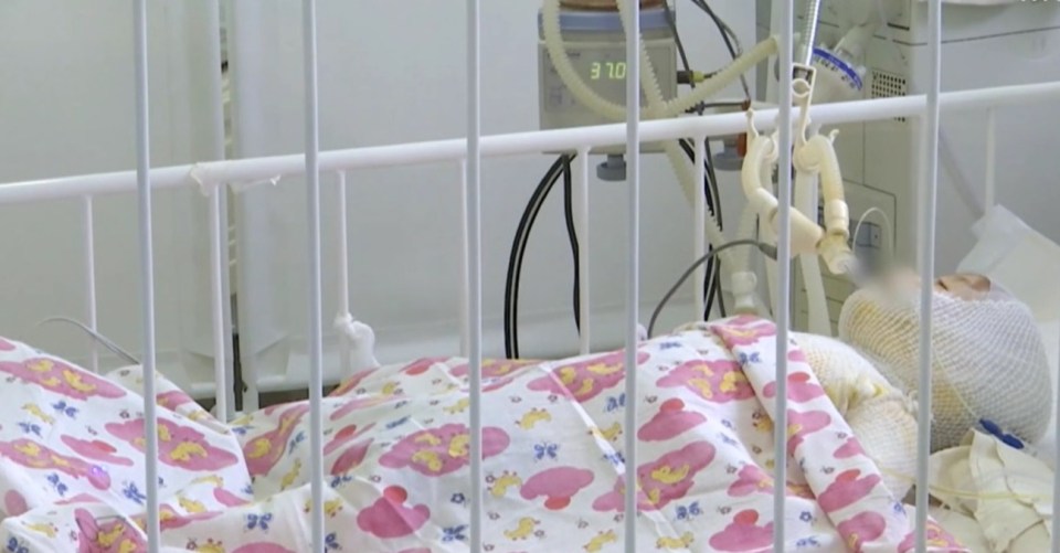 The toddler is fighting for her life after falling into scalding hot water