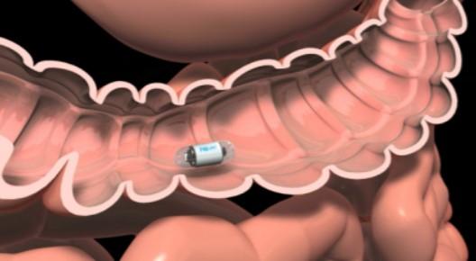 It takes two pictures a second as it passes through the digestive tract