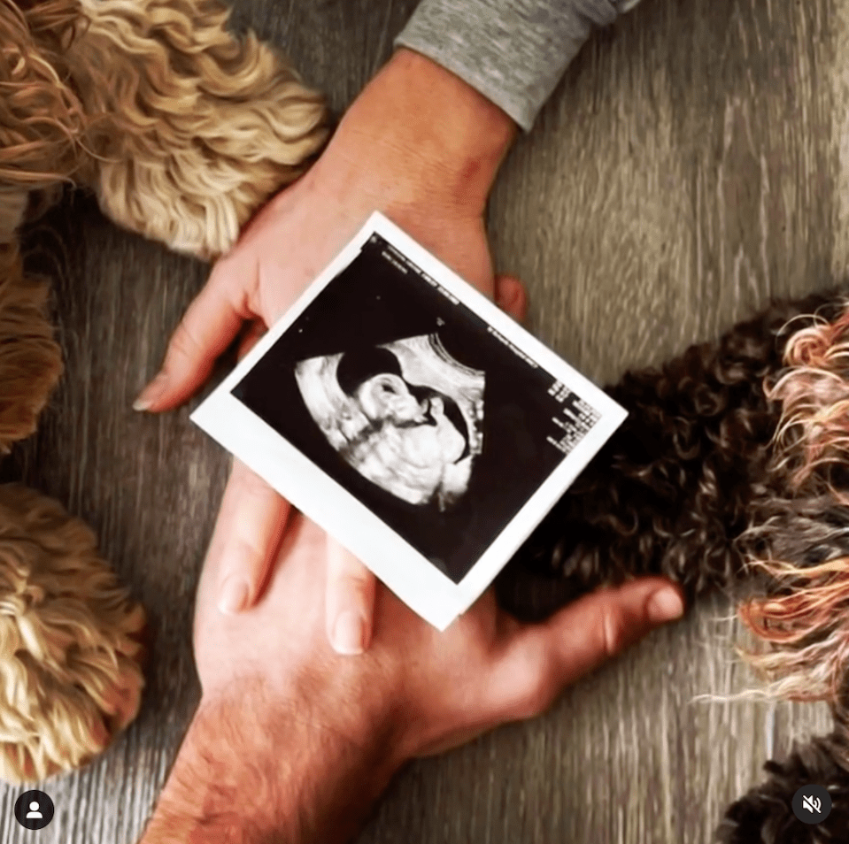 Carly Stenson and Danny Mac revealed they are having a baby with a cute video