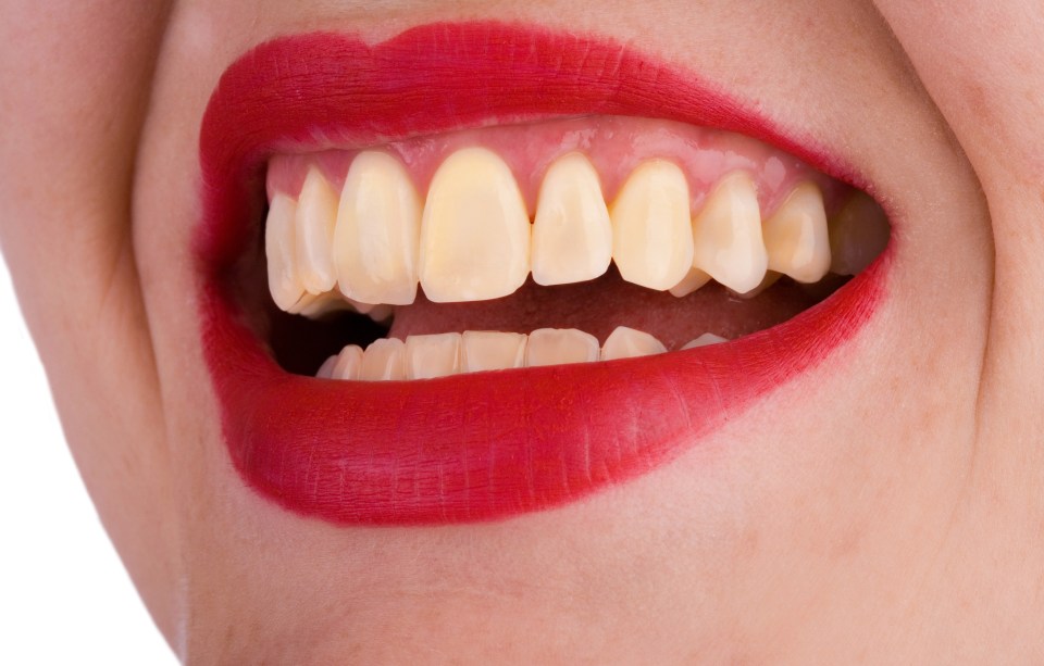 There are a number of reasons why your teeth might be stained and dentists can help