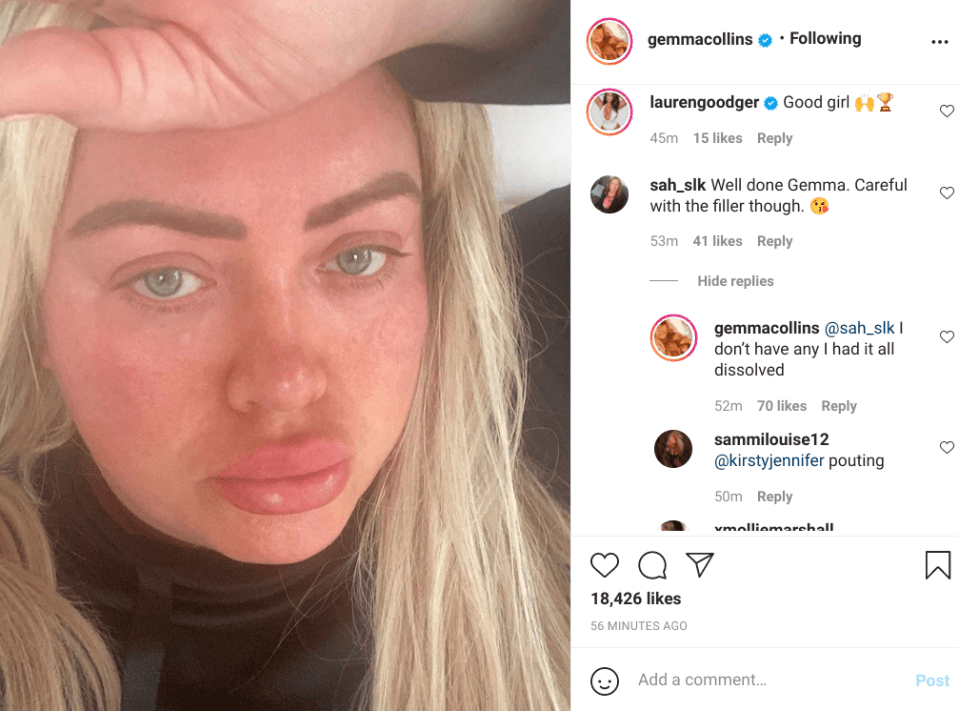 Gemma Collins has hit back at a fan who insisted she still has lip filler