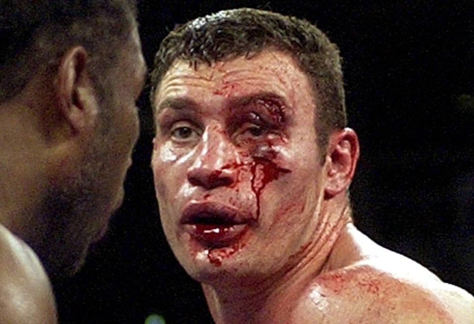 Vitali Klitschko's face was left battered by Lennox Lewis