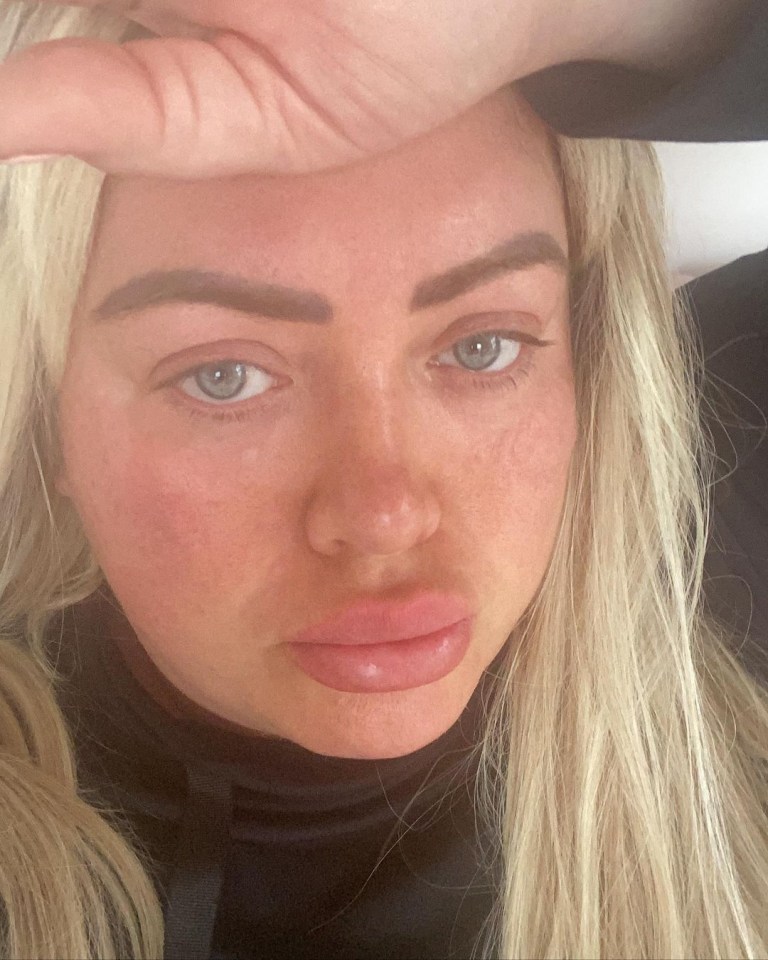 Gemma now wants to embrace a natural look after her mum said she didn't recognise her