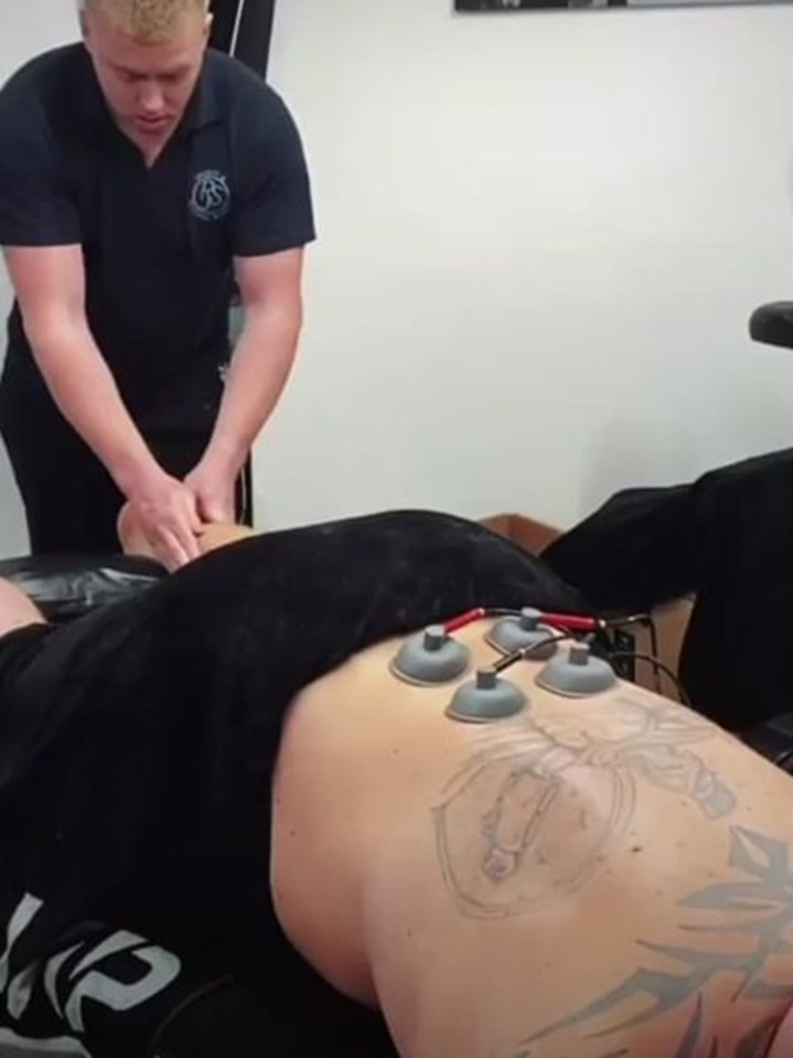 Strongman legend Hall could also be seen receiving cupping treatment as part of his recovery