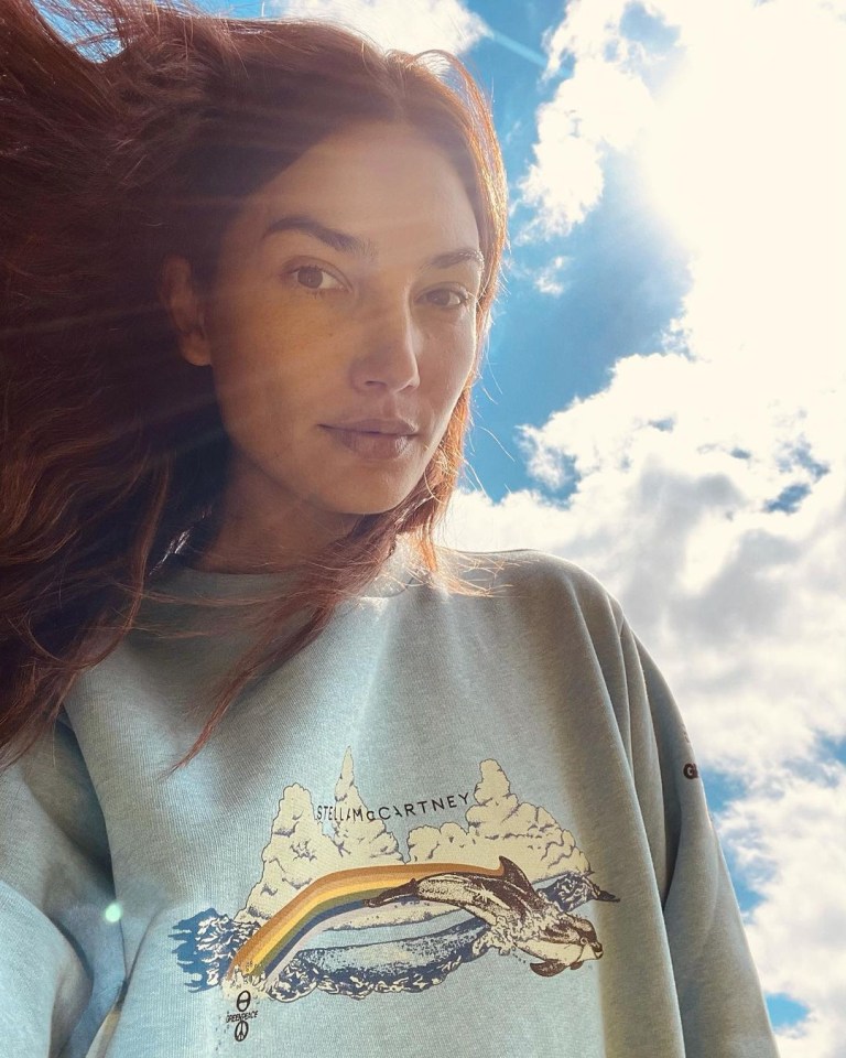 Model Lily Aldridge said she is joining a campaign to stop Amazon deforestation