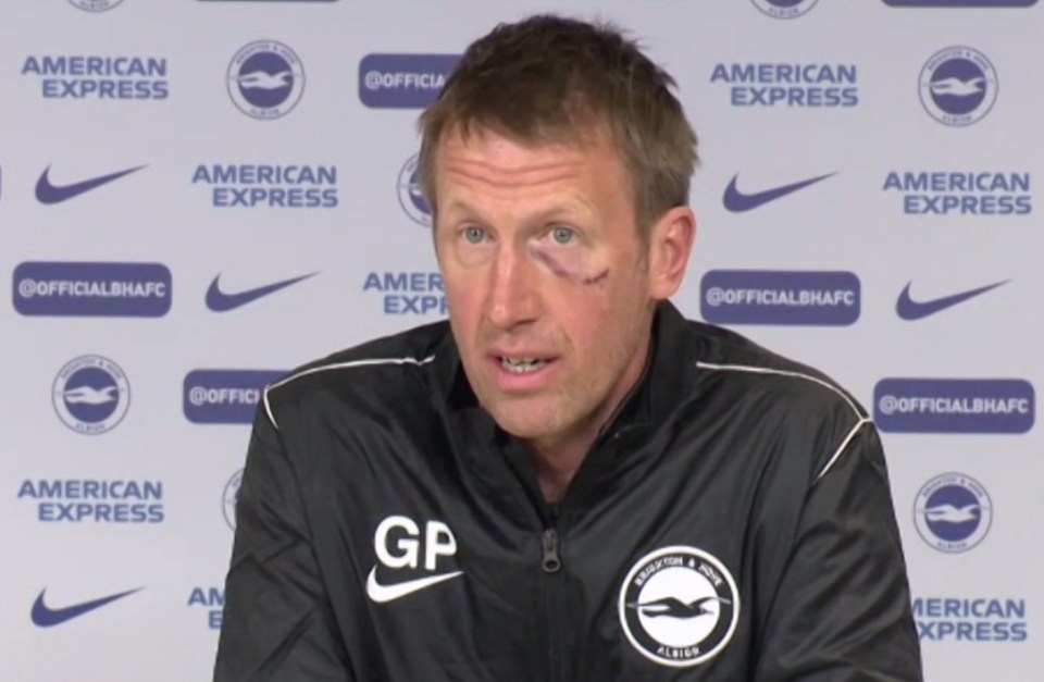 Brighton boss Graham Potter showed up for media duties sporting a huge shiner