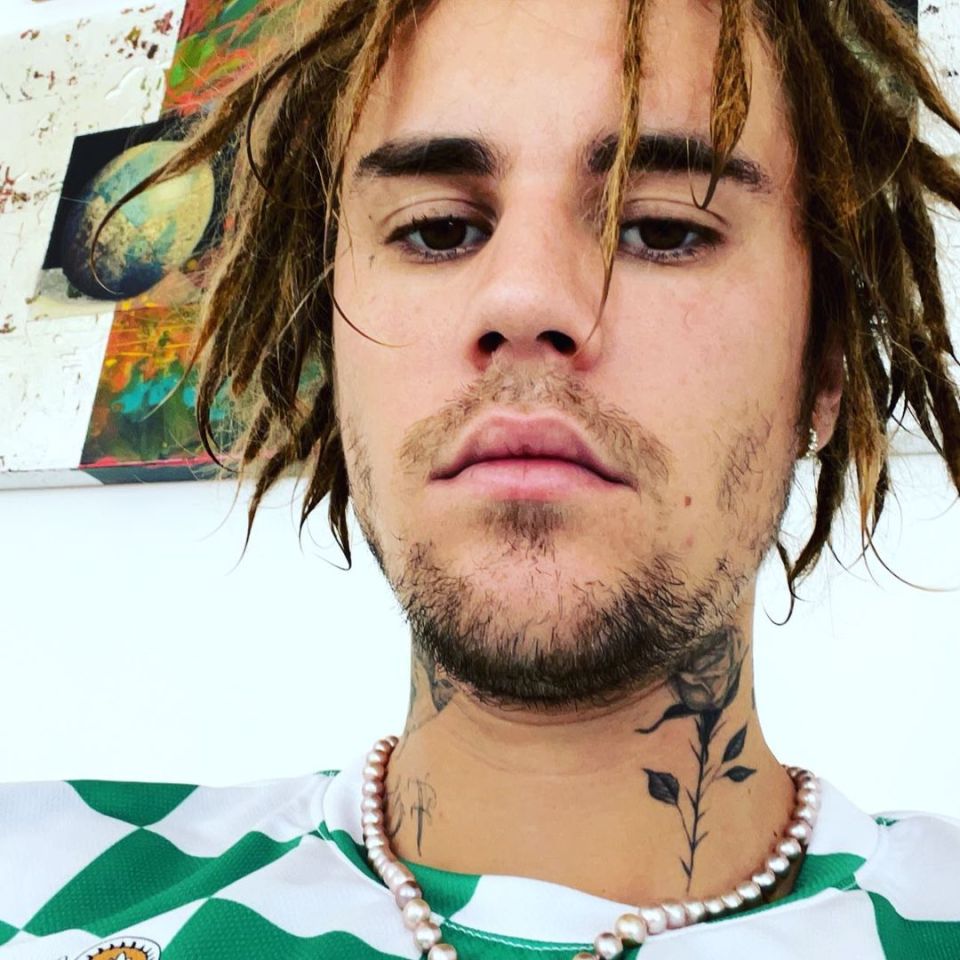 Husband Justin posted this photo of his ridiculous new dreadlocks