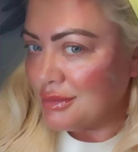 Gemma Collins reflects on her old face