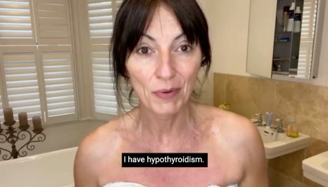 Davina told her followers she has hypothyroidism