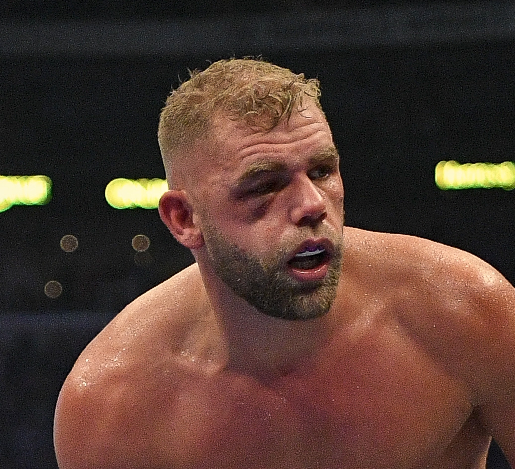 Saunders was unable to continue due to his eye injury