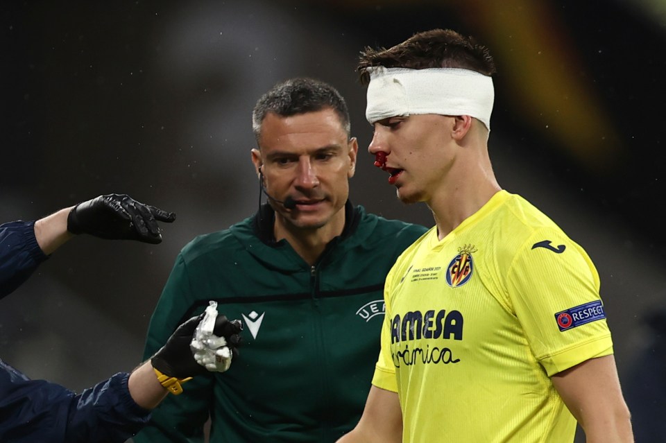 Spurs loanee Juan Foyth was left bloodied and bruised