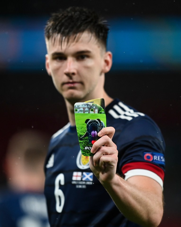 Kieran Tierney showed off his custom shin pads