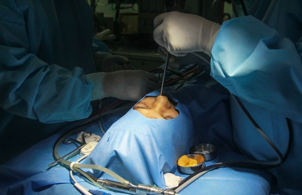 Dr Brajpal Singh Tyagi performs a surgery to remove black fungus from a patient Adesh (39) at a hospital in Ghaziabad, India on June 3