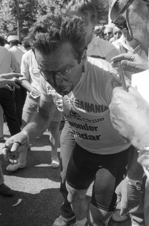 A broken nose did not deter Bernard Hinault from riding to glory