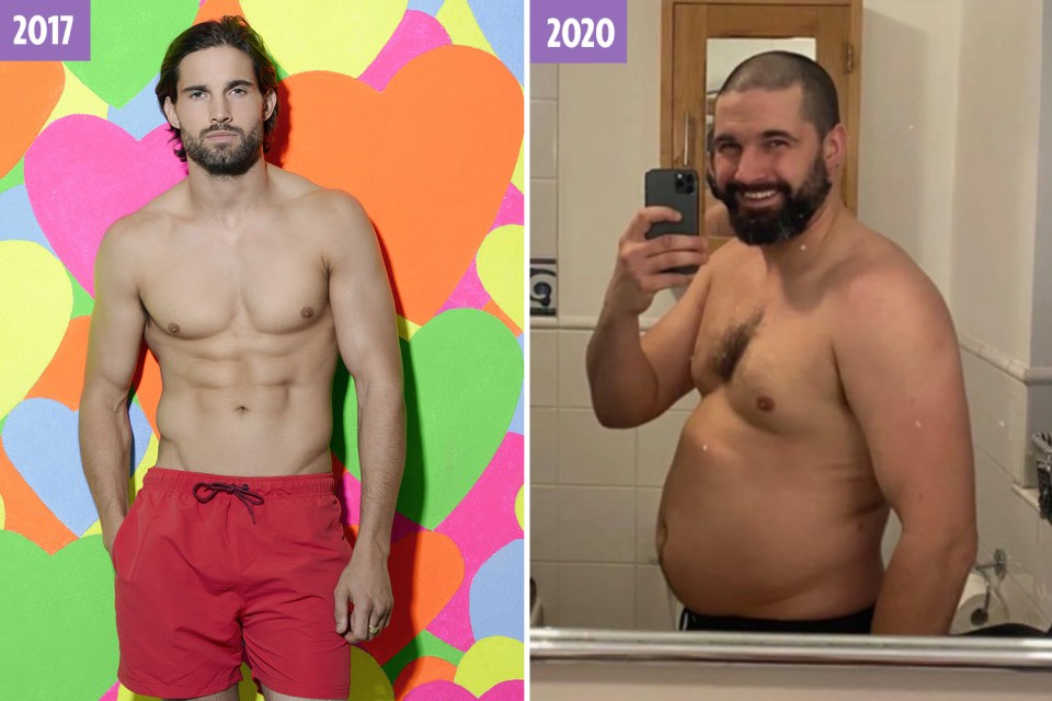 Jamie Jewitt put on four stone after leaving Love Island