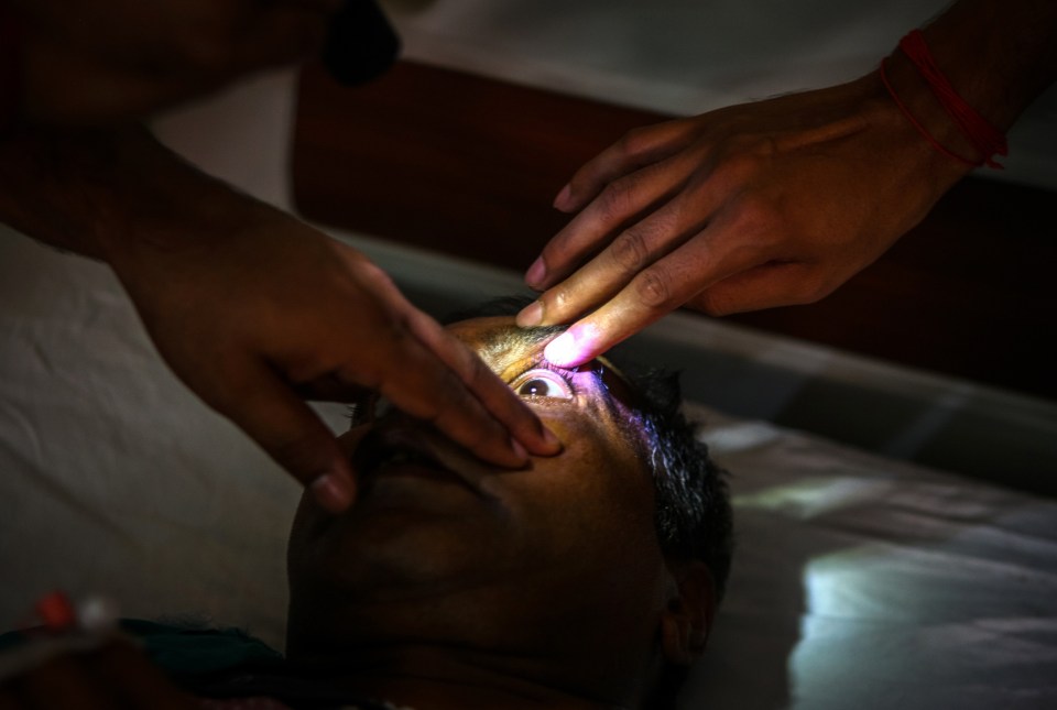 Thousands of people in India have needed eyes removed due to black fungus. Pictured: A patient is inspected at Swaroop Rani hospital, Allahabad, India, June 5