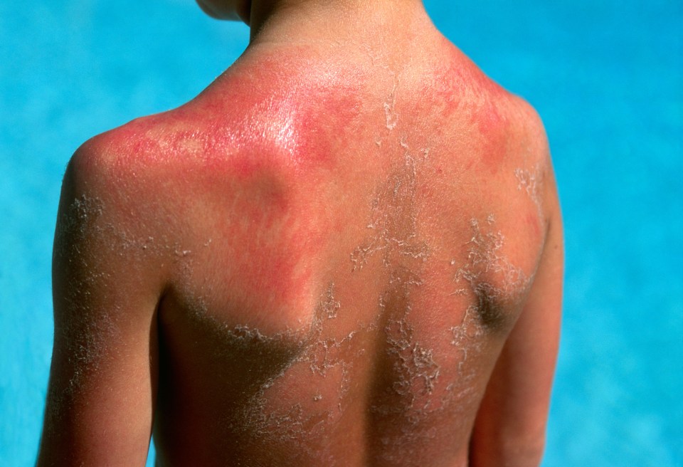 During the heatwave you should make sure your child is properly protected from the sun