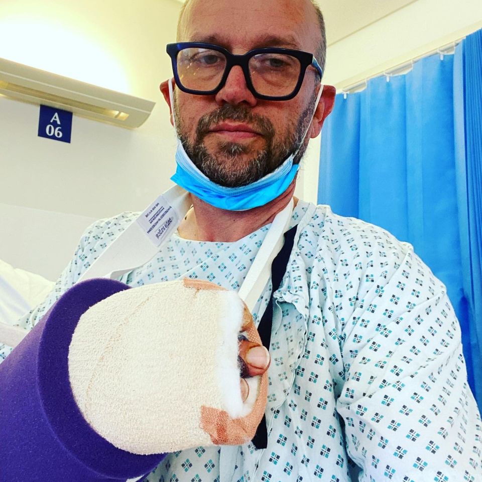 Philip Oakley also ended up in a sling after doctors scraped infected tissue out of his bitten finger