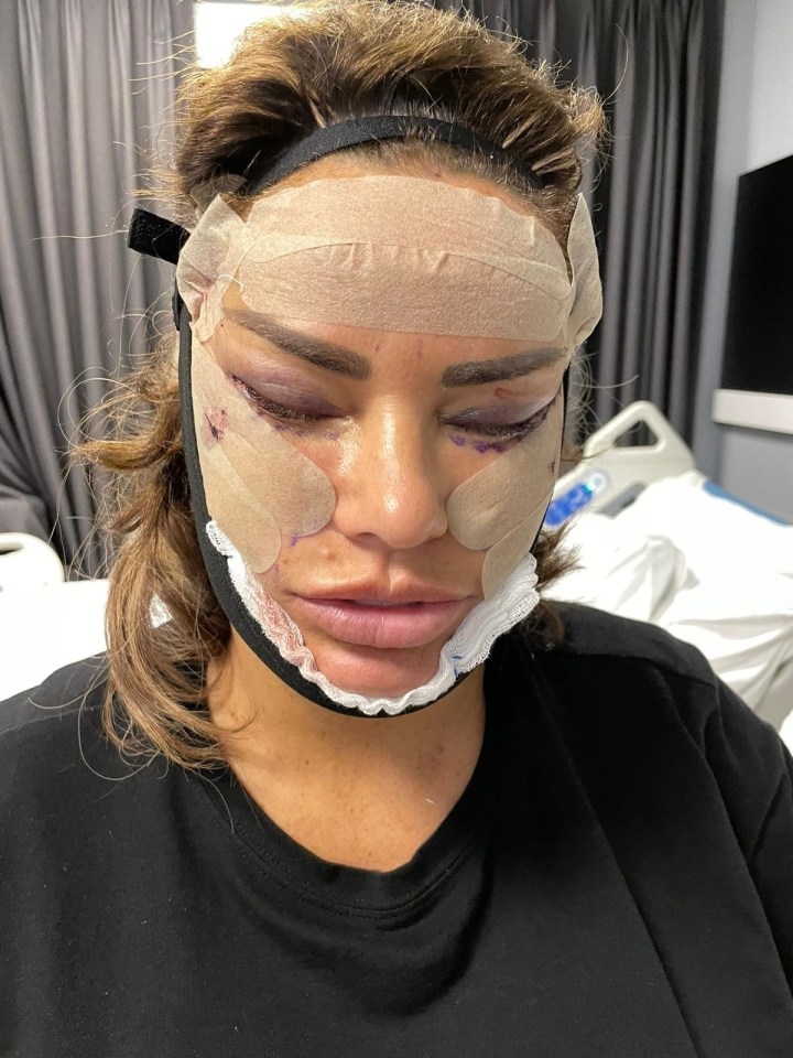 Katie Price didn't want her kids to see her after her surgery