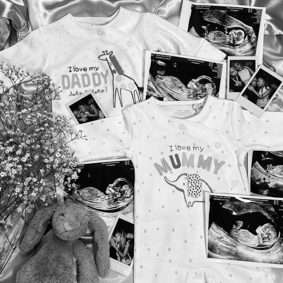 Luis and girlfriend Chloe Elizabeth shared a Polaroid snap of their baby scan