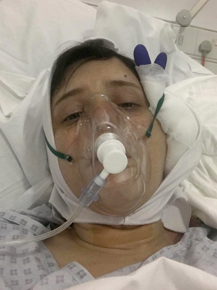 Holly pictured after having the left side of her jaw replaced