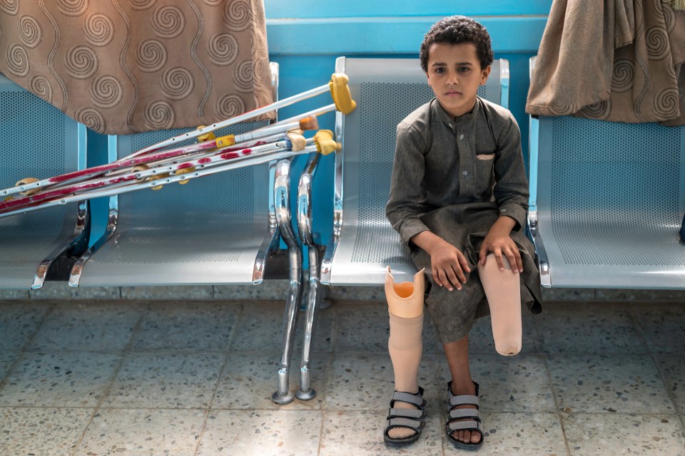 Nine-year-old Salah al Wahbel, who lost his lower left leg when he stood on an anti-personnel mine near his home in Yemen, is being treated at the The King Salman Humanitarian Aid and Relief Centre in Marib, Yemen