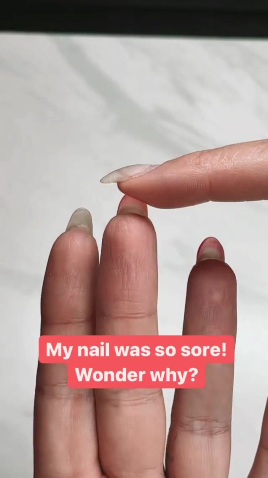 She explained what makes the nails sore.