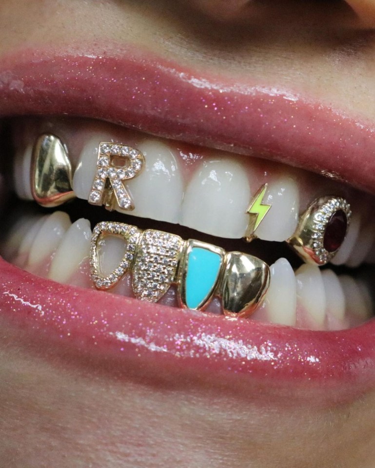 Rita showed off her mouth jewellery on Instagram, including a bejewelled letter 'R' on her front tooth