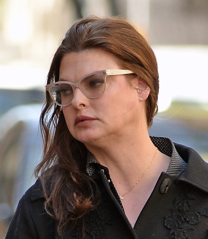 Linda Evangelista left 'unrecognisable' after fat freezing treatment goes wrong.