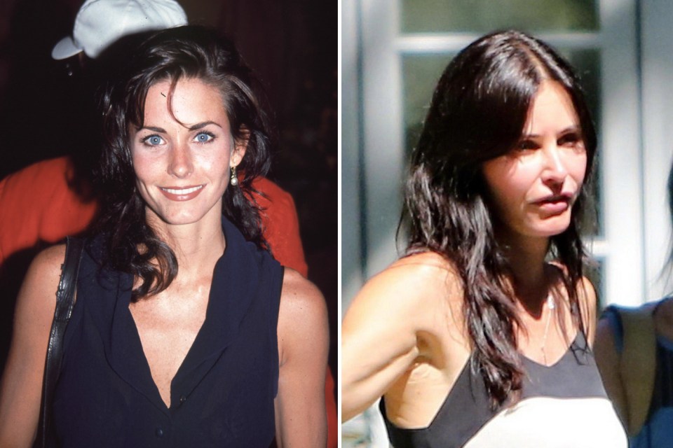 In 2017, Courteney told how she regretted using fillers and botox