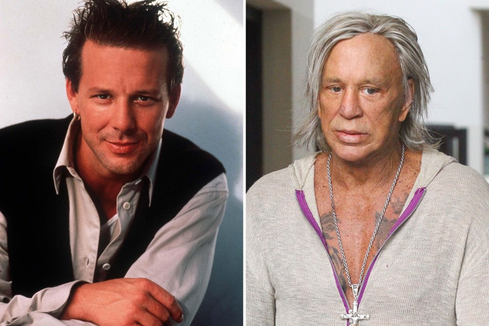 Eighties heartthrob Mickey Rourke said he needed corrective surgery