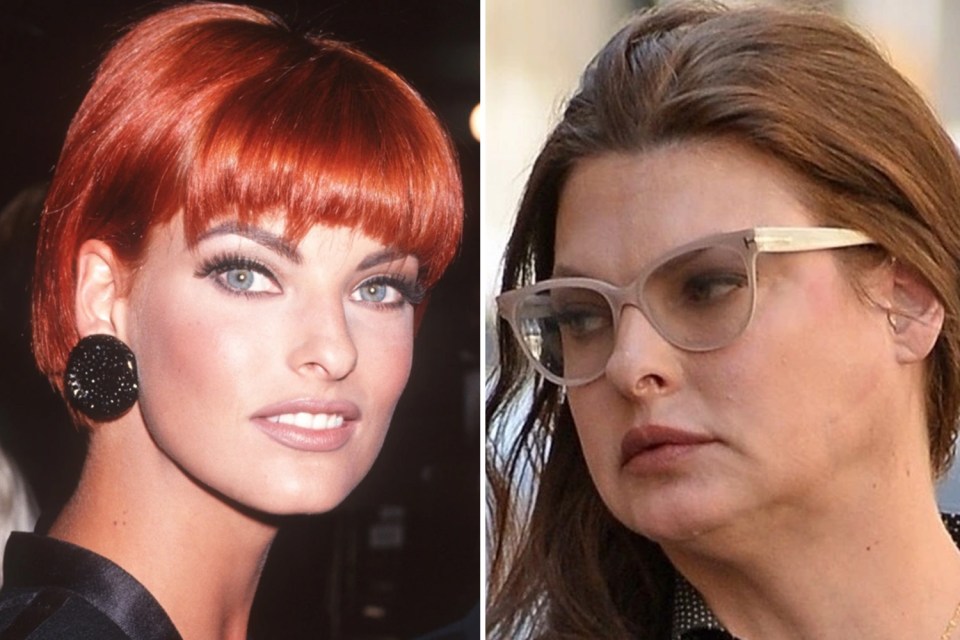 Linda Evangelista, pictured in 1991 and 2017, the latter after having adverse effects to CoolSculpting