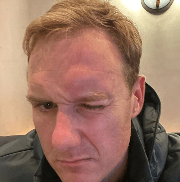 Strictly Come Dancing star Dan Walker smashed his head into a glass door