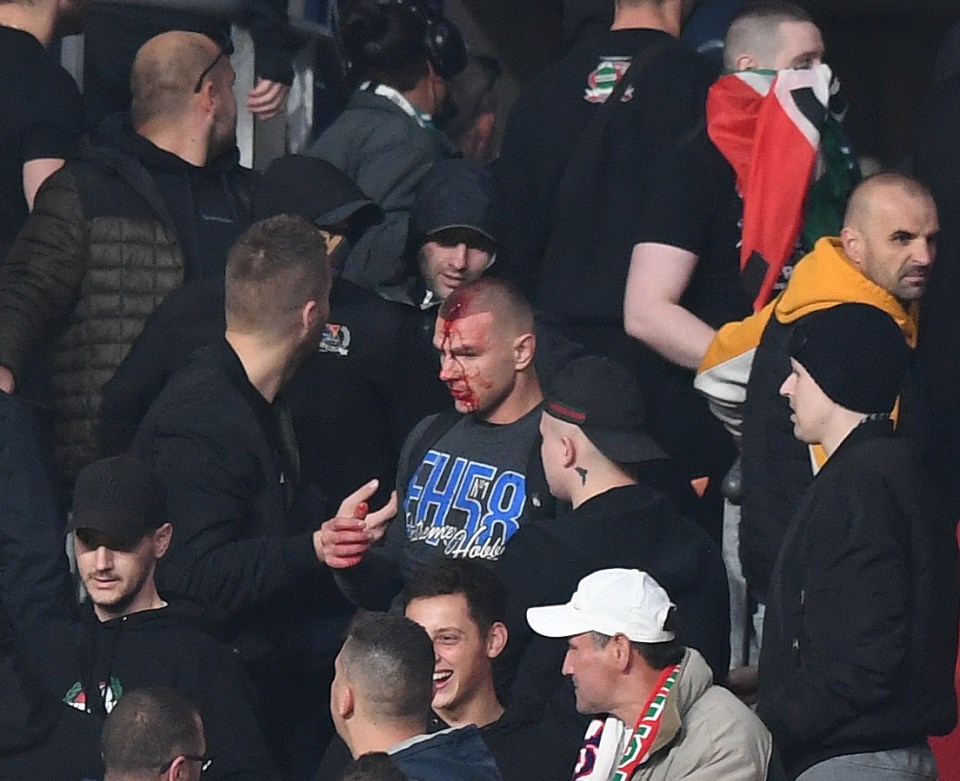 One fan had his head split open amid the chaos in the stands