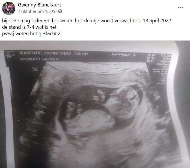 Baby number 12 is due in April 2022